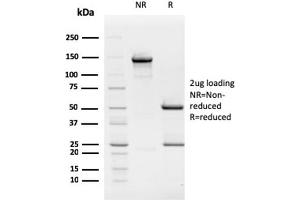 SDS-PAGE Analysis Purified Retinoblastoma (Rb1) Monoclonal Antibody (1F8). (Retinoblastoma 1 抗体)