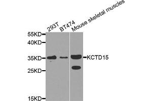 Western blot analysis of extracts of various cell lines, using KCTD15 antibody (ABIN5974815) at 1/1000 dilution. (KCTD15 抗体)