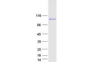 Validation with Western Blot (ADD3 Protein (Transcript Variant 3) (Myc-DYKDDDDK Tag))