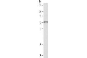 Western Blotting (WB) image for anti-ADAM Metallopeptidase Domain 10 (ADAM10) antibody (ABIN2429028) (ADAM10 抗体)