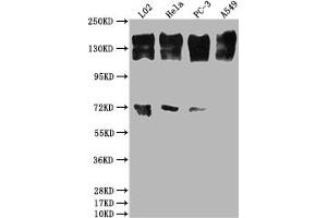 Western Blot Positive WB detected in: L02 whole cell lysate, Hela whole cell lysate, PC-3 whole cell lysate, A549 whole cell lysate All lanes: EGFR antibody at 1:2000 Secondary Goat polyclonal to rabbit IgG at 1/50000 dilution Predicted band size: 135, 45, 78, 70 kDa Observed band size: 165 kDa (Recombinant EGFR 抗体)