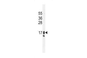 Western blot analysis in MDA-MB231 cell line lysates (35ug/lane). (PIP 抗体  (C-Term))