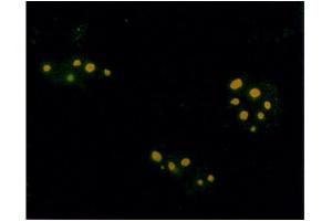 Immunofluorescence assay using anti-Farnesyl antibody on plasmids encoding isoprenylated protein and visualized using FITC- conjugated goat anti-rabbit antibody. (Farnesyl 抗体)