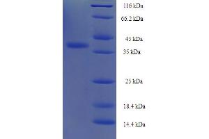 SDS-PAGE (SDS) image for Integrin Alpha2b (CD41) (AA 639-887), (partial) protein (His-SUMO Tag) (ABIN5709771) (Integrin Alpha2b Protein (CD41) (AA 639-887, partial) (His-SUMO Tag))