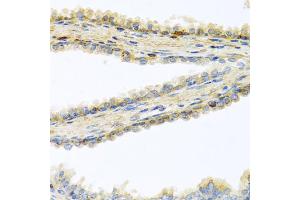 Immunohistochemistry of paraffin-embedded human prostate using GPLD1 antibody. (GPLD1 抗体)