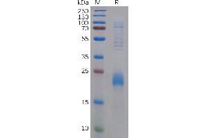 Human CD Protein, N-His Tag on SDS-PAGE under reducing condition. (CLEC2D Protein (AA 60-191) (His tag))