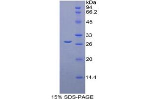 SDS-PAGE analysis of Mouse LOXL1 Protein. (LOXL1 蛋白)