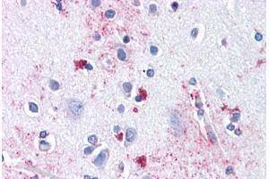 Anti-ENT1 antibody  ABIN1048564 IHC staining of human brain, cortex. (SLC29A1 抗体  (Internal Region))