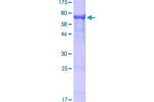 Image no. 1 for Immunoglobulin Heavy Variable 4-31 (IGHV4-31) (AA 1-470) protein (GST tag) (ABIN1307591) (IGHV4-31 Protein (AA 1-470) (GST tag))