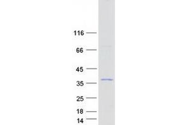 ALKBH6 Protein (Transcript Variant 2) (Myc-DYKDDDDK Tag)