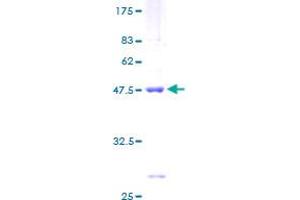 SDS-PAGE (SDS) image for Ribosomal Protein S10 (RPS10) (AA 1-165) protein (GST tag) (ABIN1318721) (RPS10 Protein (AA 1-165) (GST tag))