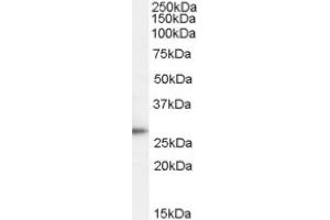 Image no. 1 for anti-Tumor Protein D52 (TPD52) (C-Term) antibody (ABIN375255) (TPD52 抗体  (C-Term))