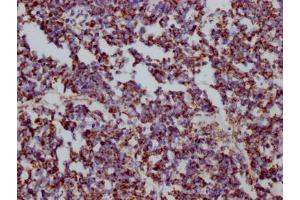 Immunohistochemistry (IHC) image for anti-Heat Shock 60kDa Protein 1 (Chaperonin) (HSPD1) antibody (ABIN7127551)