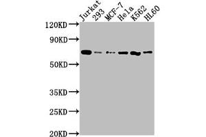 Western Blot Positive WB detected in: Jurkat whole cell lysate, 293 whole cell lysate, MCF-7 whole cell lysate, Hela whole cell lysate, K562 whole cell lysate, HL60 whole cell lysate All lanes: PTPN11 antibody at 1:2000 Secondary Goat polyclonal to rabbit IgG at 1/50000 dilution Predicted band size: 69, 53 kDa Observed band size: 69 kDa (Recombinant PTPN11 抗体)
