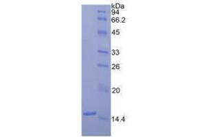 Image no. 1 for Coagulation Factor VII (F7) (AA 315-433) (Active) protein (His tag) (ABIN6239863) (Factor VII Protein (AA 315-433) (His tag))