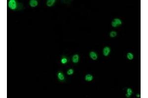 Anti-TP53 mouse monoclonal antibody (ABIN2454617) immunofluorescent staining of COS7 cells transiently transfected by pCMV6-ENTRY TP53 (RC200003). (p53 抗体)