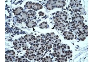 TPTE antibody was used for immunohistochemistry at a concentration of 4-8 ug/ml to stain Epithelial cells of pancreatic acinus (arrows) in Human Pancreas. (TPTE 抗体  (C-Term))