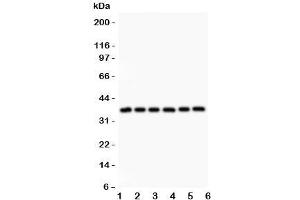 Western blot testing of Crk antibody and Lane 1:  rat spleen;  2: (r) thymus;  3: (r) liver;  4: mouse brain;  5: human HeLa;  6: (h) SMMC-7721 lysate. (Crk 抗体  (AA 2-246))