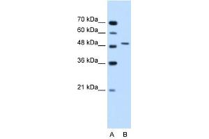 Semenogelin I antibody used at 1. (SEMG1 抗体  (N-Term))