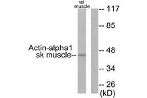 Western Blotting (WB) image for anti-Actin, alpha 1, Skeletal Muscle (ACTA1) (AA 1-50) antibody (ABIN2889169) (Actin 抗体  (AA 1-50))