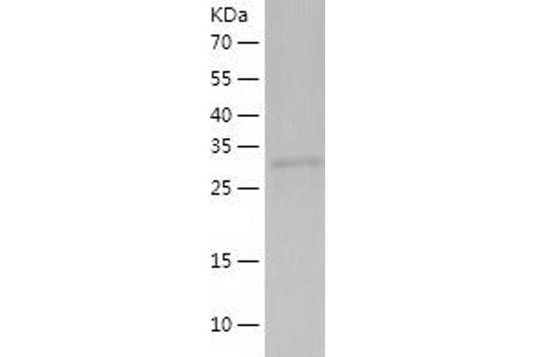 CCDC69 Protein (AA 1-296) (His tag)