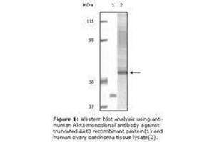 Image no. 1 for anti-V-Akt Murine Thymoma Viral Oncogene Homolog 3 (Protein Kinase B, Gamma) (AKT3) antibody (ABIN232105) (AKT3 抗体)