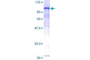 Image no. 1 for Radixin (RDX) (AA 1-583) protein (GST tag) (ABIN1317740) (Radixin Protein (RDX) (AA 1-583) (GST tag))