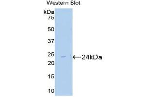 Detection of Recombinant Smad2, Mouse using Polyclonal Antibody to Mothers Against Decapentaplegic Homolog 2 (Smad2) (SMAD2 抗体  (AA 272-467))