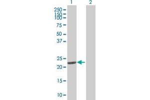 Western Blot analysis of DHFR expression in transfected 293T cell line by DHFR MaxPab polyclonal antibody. (Dihydrofolate Reductase 抗体  (AA 1-187))