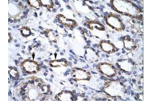 Image no. 1 for anti-Autophagy related 4B Cysteine Peptidase (ATG4B) (C-Term) antibody (ABIN6735868) (ATG4B 抗体  (C-Term))