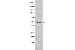 Western blot analysis of ALDH3A1 using K562 whole cell lysates (ALDH3A1 抗体  (C-Term))