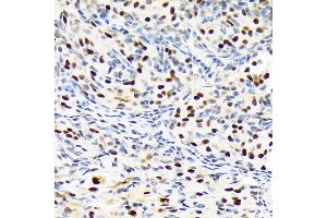 Immunohistochemistry of paraffin-embedded rat ovary using PBRM1 Rabbit mAb (ABIN1512585, ABIN3020942, ABIN3020943 and ABIN7101308) at dilution of 1:100 (40x lens). (Polybromo 1 抗体)