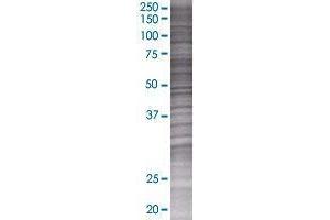 AGTRAP transfected lysate. (AGTRAP 293T Cell Transient Overexpression Lysate(Denatured))