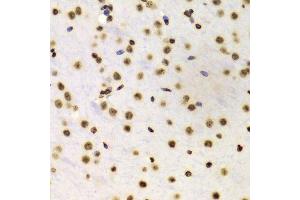 Immunohistochemistry (Paraffin-embedded Sections) (IHC (p)) image for anti-Histone 3 (H3) (H3K4me) antibody (ABIN3023251)