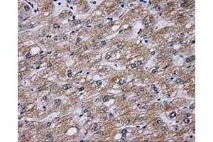 Immunohistochemical staining of paraffin-embedded liver tissue using anti-BTK mouse monoclonal antibody. (BTK 抗体)