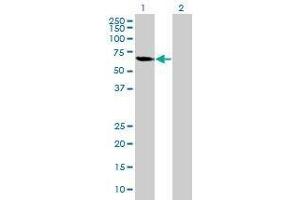 Lane 1: KIAA0368 transfected lysate ( 57. (KIAA0368 293T Cell Transient Overexpression Lysate(Denatured))