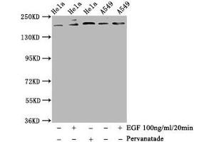 Western Blot Positive WB detected in Hela whole cell lysate,A549 whole cell lysate(treated with EGF or Pervanadate) All lanes Phospho-PDGFRB antibody at 1. (Recombinant PDGFRB 抗体  (pTyr740))