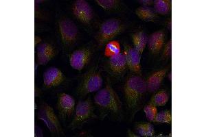 Immunofluorescence (IF) image for anti-Nuclear Factor of kappa Light Polypeptide Gene Enhancer in B-Cells 1 (NFKB1) (pSer337) antibody (ABIN1870464) (NFKB1 抗体  (pSer337))