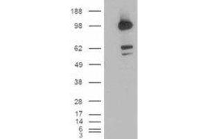 HEK293 overexpressing CDCP1 and probed with ABIN2561770 (mock transfection in first lane). (CDCP1 抗体  (C-Term, Isoform 1))