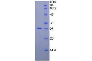 SDS-PAGE analysis of Human NEFM Protein. (NEFM 蛋白)