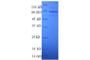 TLN1 Protein (AA 92-399, partial) (GST tag)