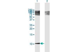 Western Blot analysis of BGLAP expression in transfected 293T cell line by BGLAP MaxPab polyclonal antibody. (Osteocalcin 抗体  (AA 1-100))