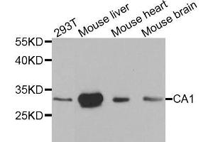 Western blot analysis of extracts of various cell lines, using CA1 antibody. (CA1 抗体  (AA 1-261))
