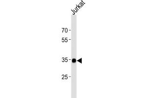 Western Blotting (WB) image for anti-SRY (Sex Determining Region Y)-Box 18 (SOX18) antibody (ABIN2998551) (SOX18 抗体)