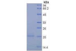 SDS-PAGE analysis of Human Mucin 5AC Protein. (MUC5AC 蛋白)