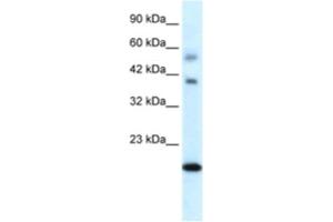 Western Blotting (WB) image for anti-BolA-like Protein 1 (BOLA1) antibody (ABIN2460373) (BOLA1 抗体)