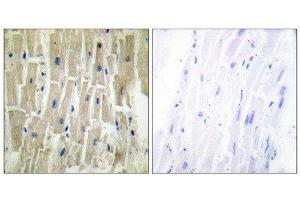 Immunohistochemistry (IHC) image for anti-PDZ and LIM Domain 1 (PDLIM1) (Internal Region) antibody (ABIN1848910) (PDLIM1 抗体  (Internal Region))