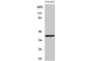 Western Blotting (WB) image for anti-Distal-Less Homeobox 4 (DLX4) (Internal Region) antibody (ABIN3184316) (DLX4 抗体  (Internal Region))