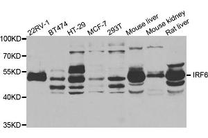 Western blot analysis of extracts of various cell lines, using IRF6 antibody. (IRF6 抗体)