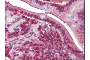 Human Small Intestine (formalin-fixed, paraffin-embedded) stained with PPP4Cfollowed by biotinylated secondary antibody, alkaline phosphatase-streptavidin and chromogen. (PPP4C 抗体  (C-Term))